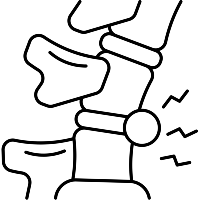chiropractic disc herniation treatment red deer
