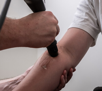 shockwave therapy red deer